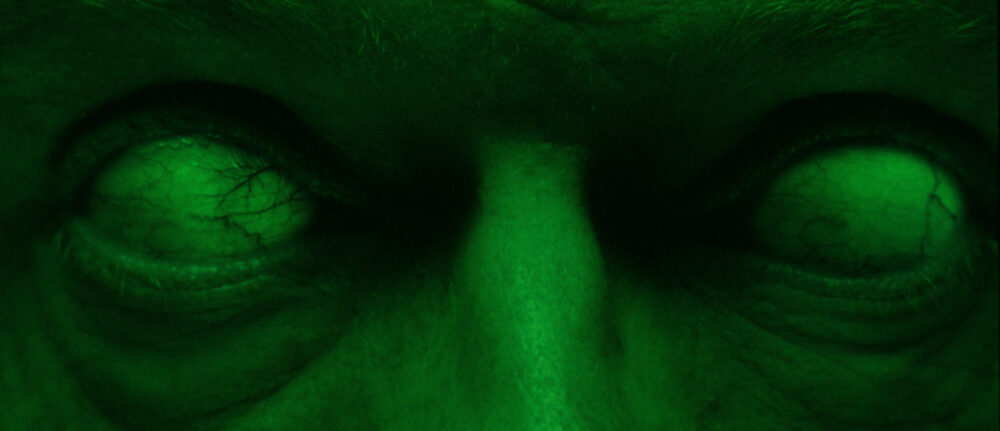 Close-up of bloodshot eyes with a green tint.