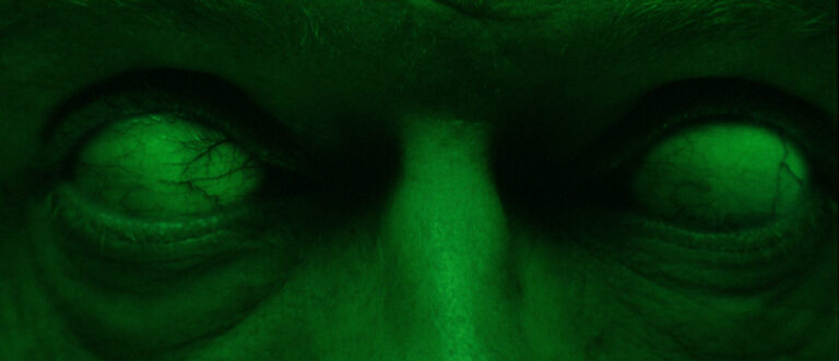 Close-up of bloodshot eyes with a green tint.