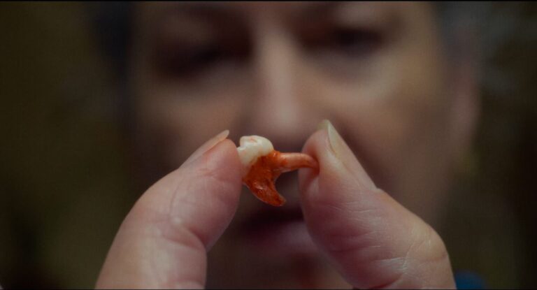 Woman holding a bloody tooth between her fingers. A lost "tooth" is shown up close.